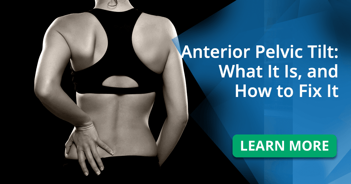 How To Fix Anterior Pelvic Tilt Posture - 10 Exercises